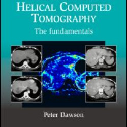 Protocols for Multislice Helical Computed Tomography Protocols for Multislice Helical Computed Tomography
