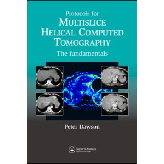Protocols for Multislice Helical Computed Tomography Protocols for Multislice Helical Computed Tomography