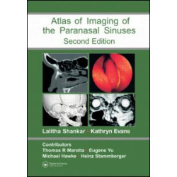 Atlas of Imaging of the Paranasal Sinuses, Second Edition Atlas of Imaging of the Paranasal Sinuses, Second Edition