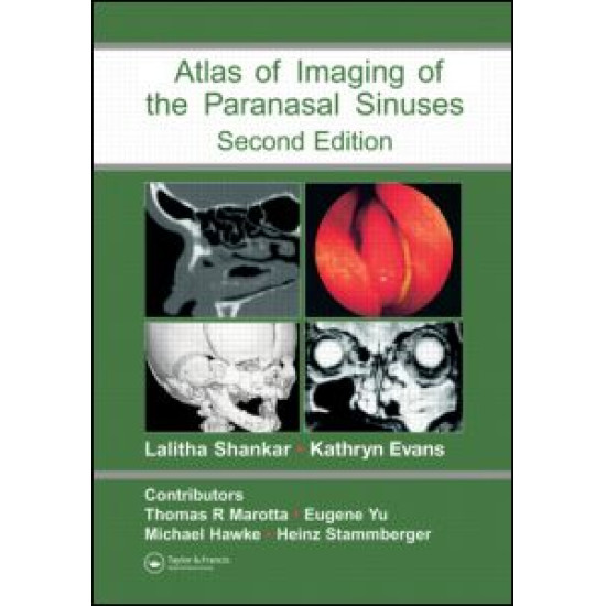 Atlas of Imaging of the Paranasal Sinuses, Second Edition