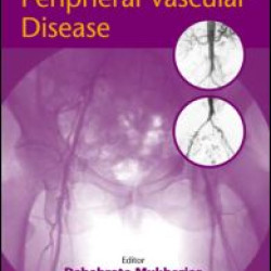 Pharmacological Therapies for Peripheral Vascular Disease