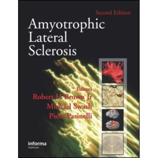 Amyotrophic Lateral Sclerosis, Second Edition Amyotrophic Lateral Sclerosis, Second Edition