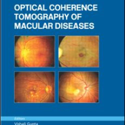Atlas of Optical Coherence Tomography of Macular Diseases