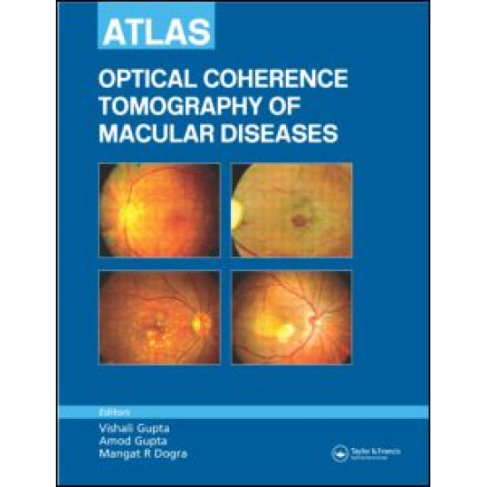 Atlas of Optical Coherence Tomography of Macular Diseases