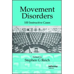 Movement Disorders Movement Disorders