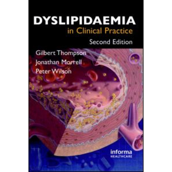 Dyslipidaemia in Clinical Practice