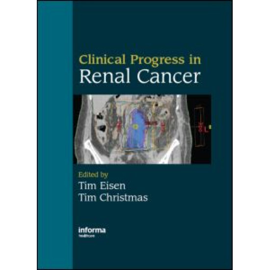 Clinical Progress in Renal Cancer Clinical Progress in Renal Cancer