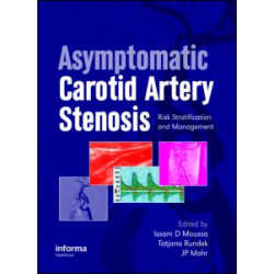 Asymptomatic Carotid Artery Stenosis Asymptomatic Carotid Artery Stenosis
