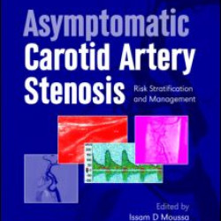 Asymptomatic Carotid Artery Stenosis Asymptomatic Carotid Artery Stenosis