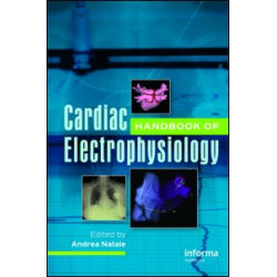 Handbook of Cardiac Electrophysiology Handbook of Cardiac Electrophysiology
