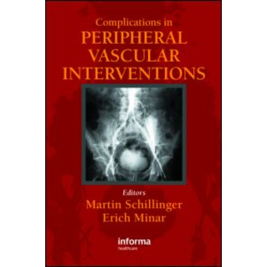 Complications in Peripheral Vascular Interventions Complications in Peripheral Vascular Interventions