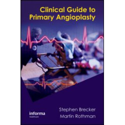 Clinical Guide to Primary Angioplasty Clinical Guide to Primary Angioplasty
