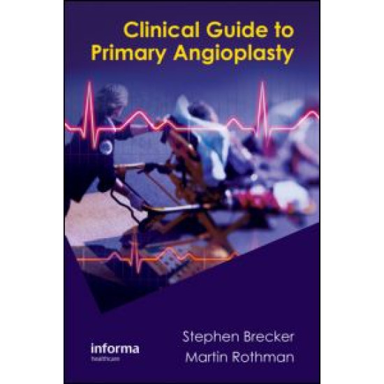 Clinical Guide to Primary Angioplasty Clinical Guide to Primary Angioplasty
