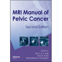 MRI Manual of Pelvic Cancer,Second Edition MRI Manual of Pelvic Cancer,Second Edition