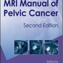 MRI Manual of Pelvic Cancer,Second Edition MRI Manual of Pelvic Cancer,Second Edition
