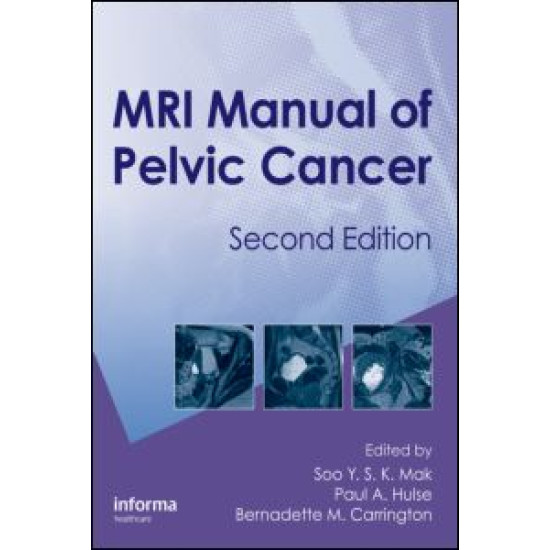 MRI Manual of Pelvic Cancer,Second Edition MRI Manual of Pelvic Cancer,Second Edition