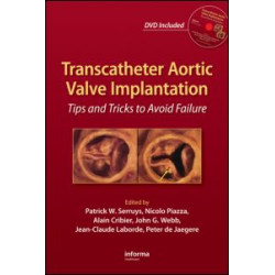 Transcatheter Aortic Valve Implantation Transcatheter Aortic Valve Implantation