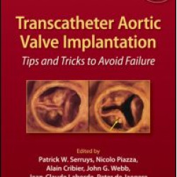 Transcatheter Aortic Valve Implantation Transcatheter Aortic Valve Implantation