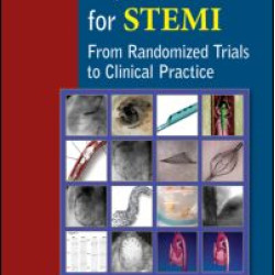 Mechanical Reperfusion for STEMI Mechanical Reperfusion for STEMI
