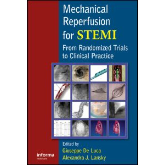 Mechanical Reperfusion for STEMI Mechanical Reperfusion for STEMI