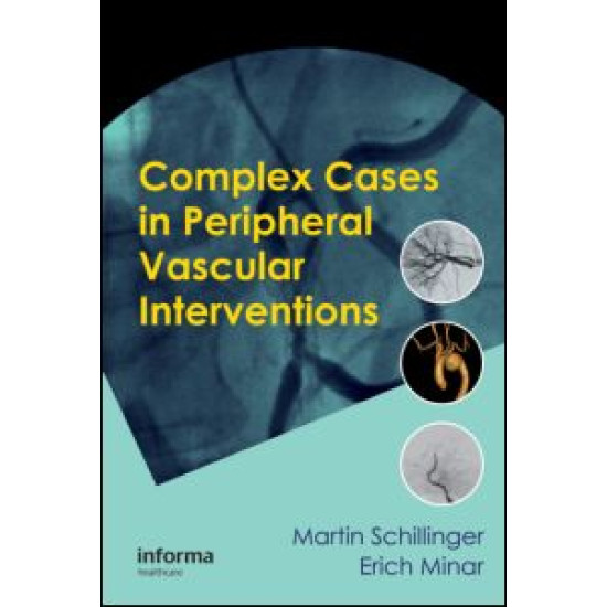 Complex Cases in Peripheral Vascular Interventions Complex Cases in Peripheral Vascular Interventions