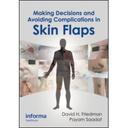 Making Decisions and Avoiding Complications in Skin Flaps