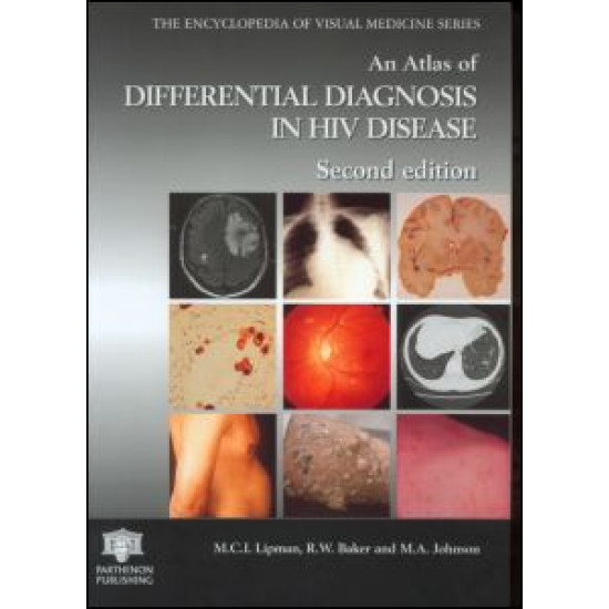 An Atlas of Differential Diagnosis in HIV Disease An Atlas of Differential Diagnosis in HIV Disease