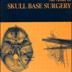 Atlas of Skull Base Surgery Atlas of Skull Base Surgery