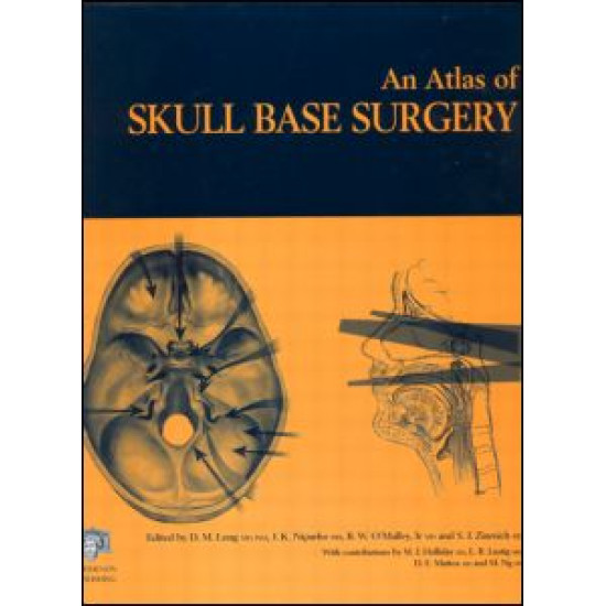 Atlas of Skull Base Surgery