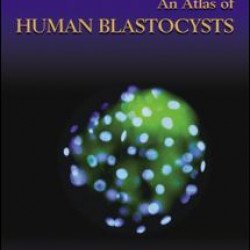An Atlas of Human Blastocysts An Atlas of Human Blastocysts