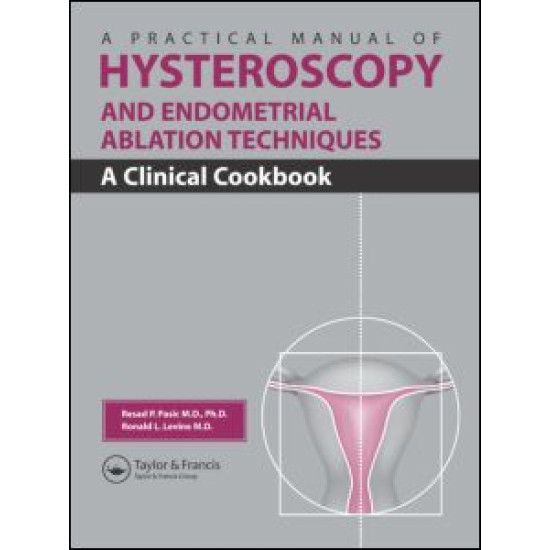 A Practical Manual of Hysteroscopy and Endometrial Ablation Techniques