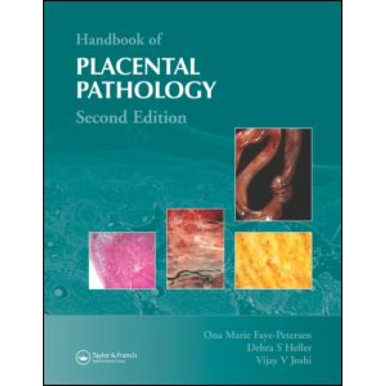 Handbook of Placental Pathology