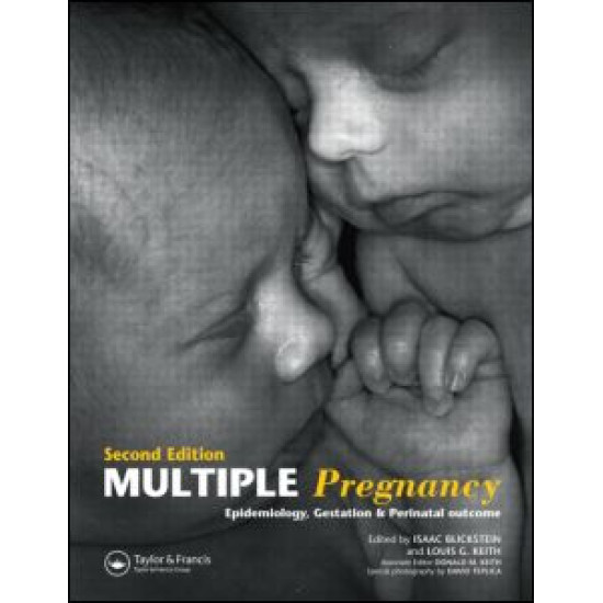 Multiple Pregnancy