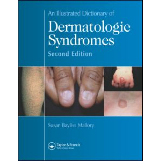An Illustrated Dictionary of Dermatologic Syndromes An Illustrated Dictionary of Dermatologic Syndromes