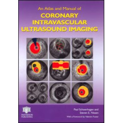 An Atlas and Manual of Coronary Intravascular Ultrasound Imaging An Atlas and Manual of Coronary Intravascular Ultrasound Imaging