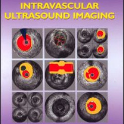 An Atlas and Manual of Coronary Intravascular Ultrasound Imaging