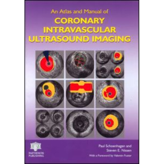 An Atlas and Manual of Coronary Intravascular Ultrasound Imaging