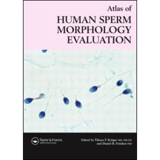 Atlas of Human Sperm Morphology Evaluation Atlas of Human Sperm Morphology Evaluation