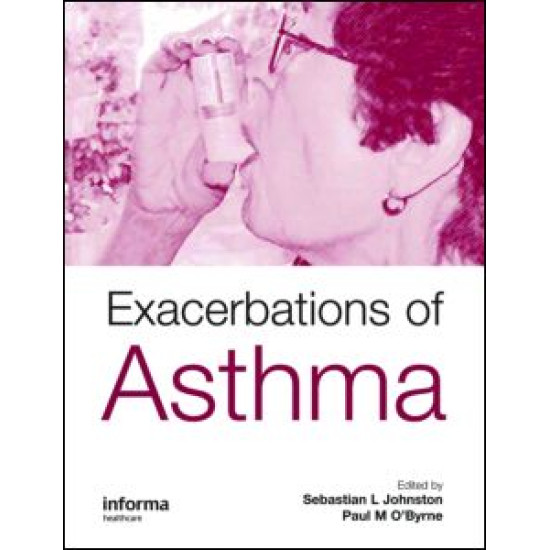 Exacerbations of Asthma Exacerbations of Asthma
