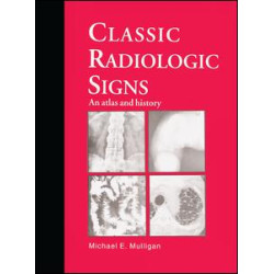 Classic Radiologic Signs Classic Radiologic Signs