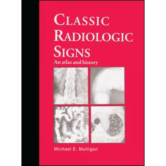 Classic Radiologic Signs