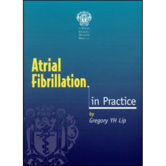 Atrial Fibrillation in Practice