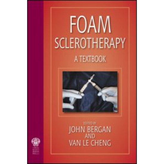 Foam Sclerotherapy: A Textbook