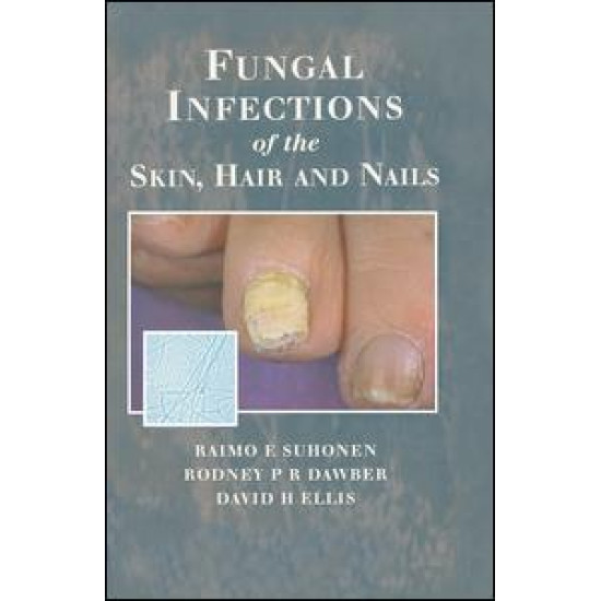 Fungal Infections of the Skin and Nails