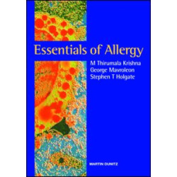 Essentials of Allergy Essentials of Allergy