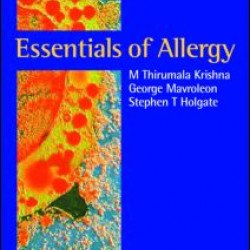 Essentials of Allergy Essentials of Allergy