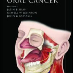 Oral Cancer