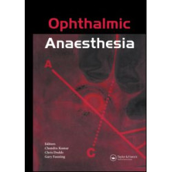 Ophthalmic Anaesthesia Ophthalmic Anaesthesia