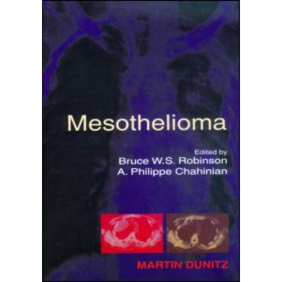 Mesothelioma Mesothelioma