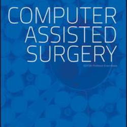 Computer Assisted Surgery